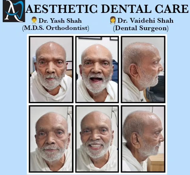 Aesthetic Dental Care - Kankaria