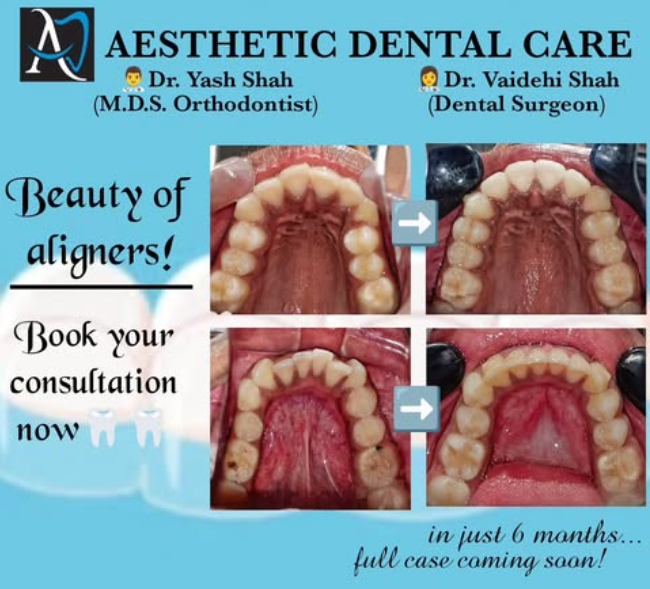 Aesthetic Dental Care - Kankaria